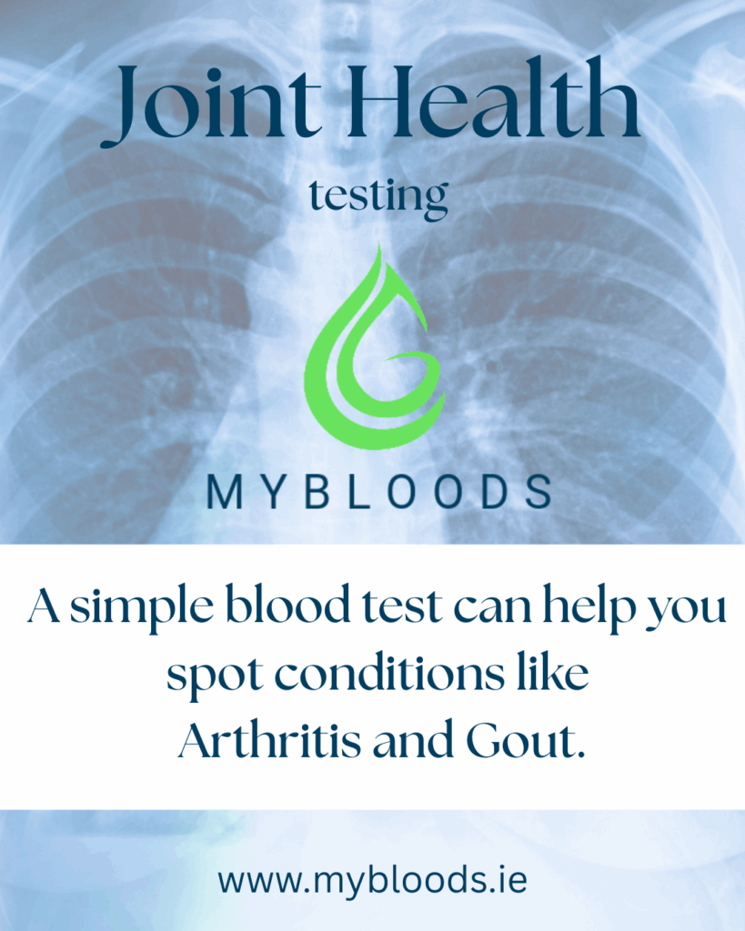 Joint Health - a simple blood test can help you spot conditions like arthritis and gout.